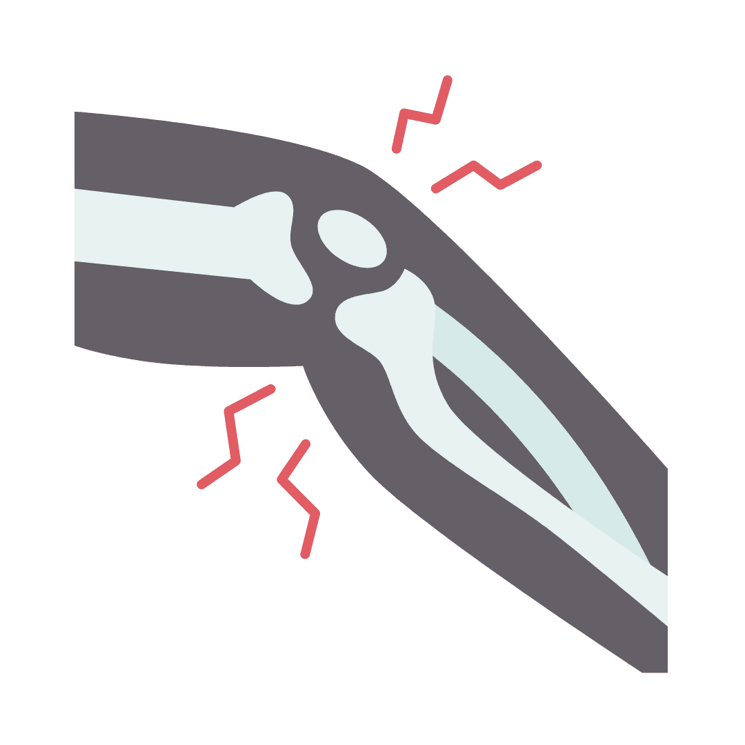 Articulations (inflammation)