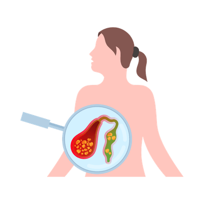 Stase biliaire (cholestase)